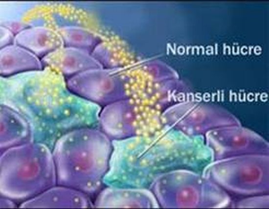 Kanser Nedir ?